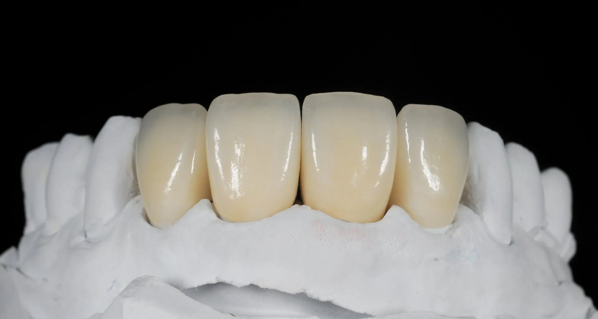 Full Zirconia Crown