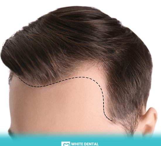 Hair Transplants and Treatment