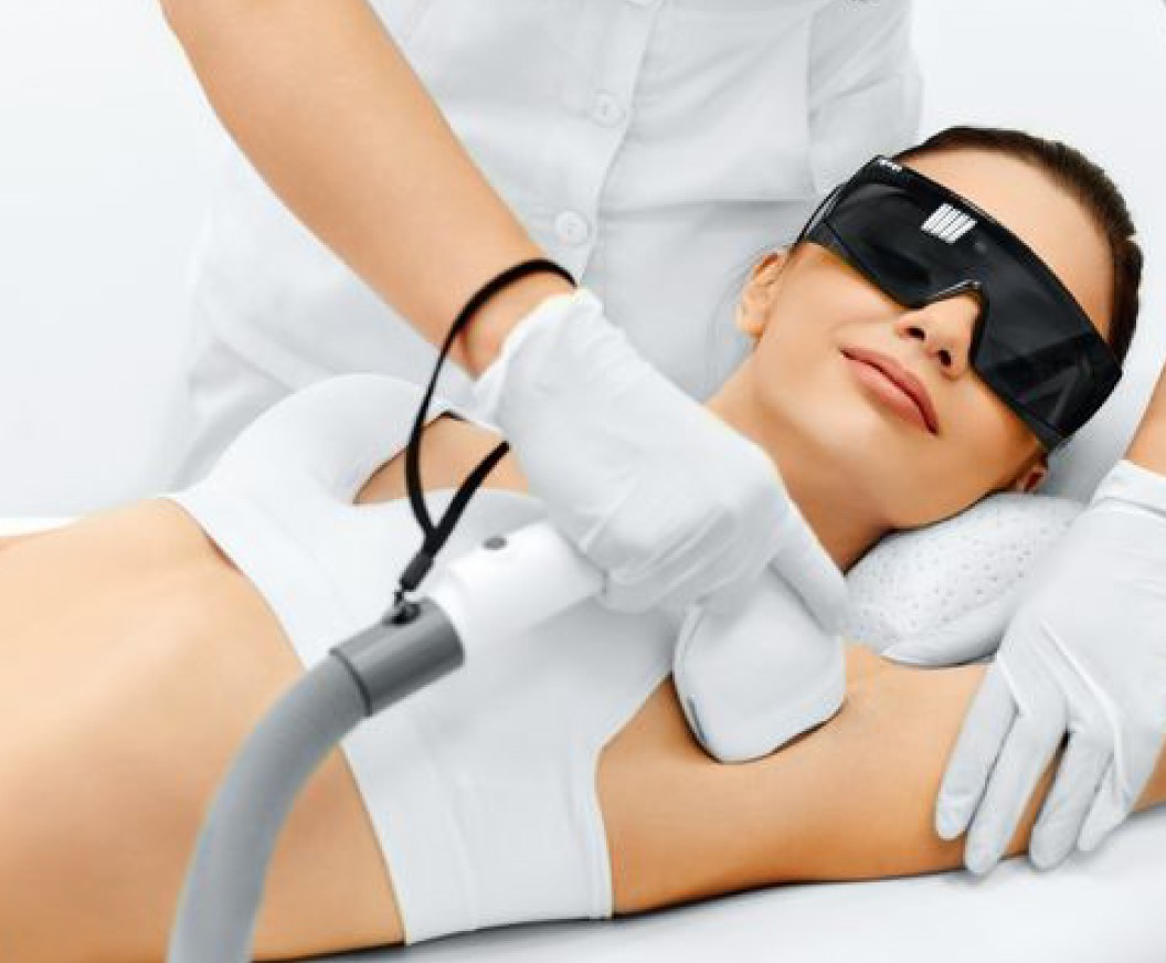 Laser hair removal