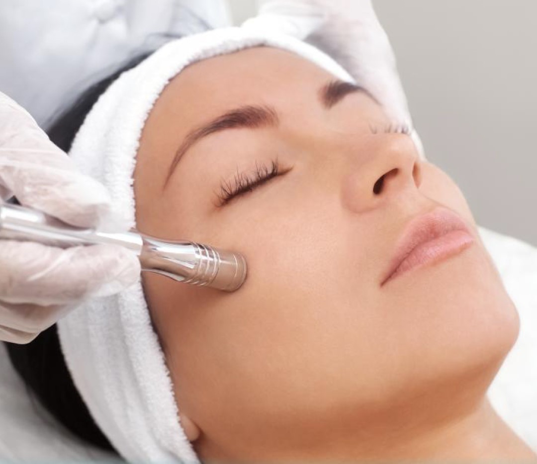 Radiofrequency Treatment