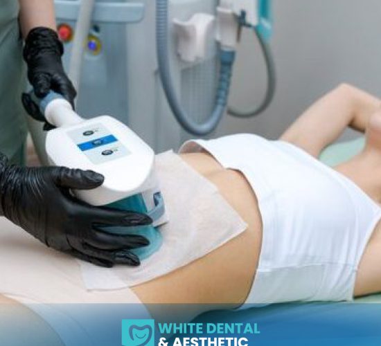 Cryolipolysis